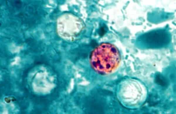 magnified Cyclospora
